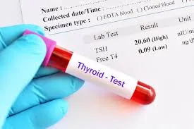 THYROID PROFILE
