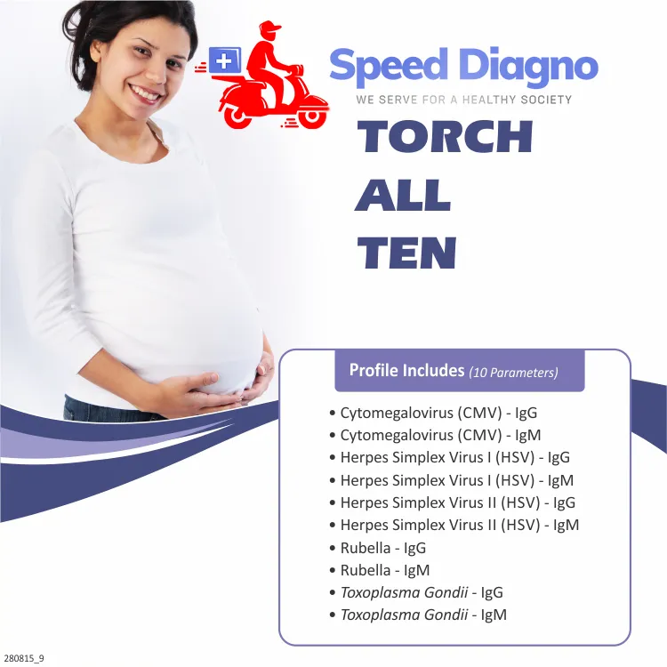 TORCH PROFILE