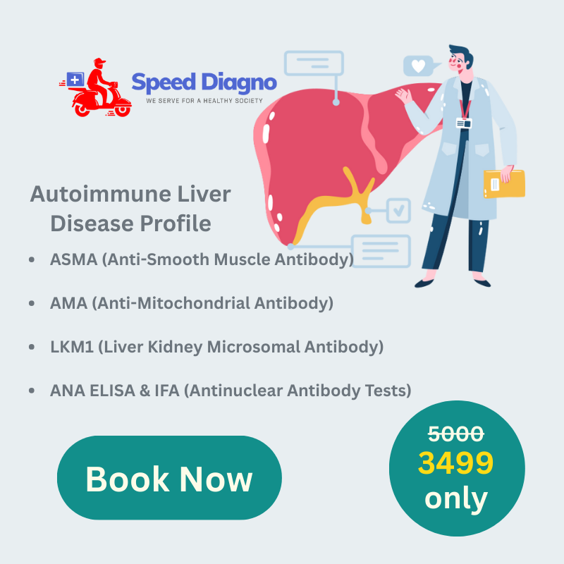Autoimmune Liver Disease Profile