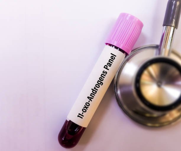 💉 SpeedDiagno Androgen Panel  💉