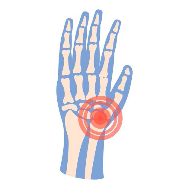 Speed Arthritis Basic profile