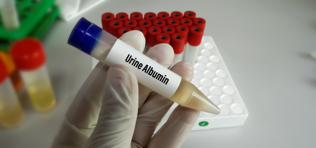 URINE ALBUMIN