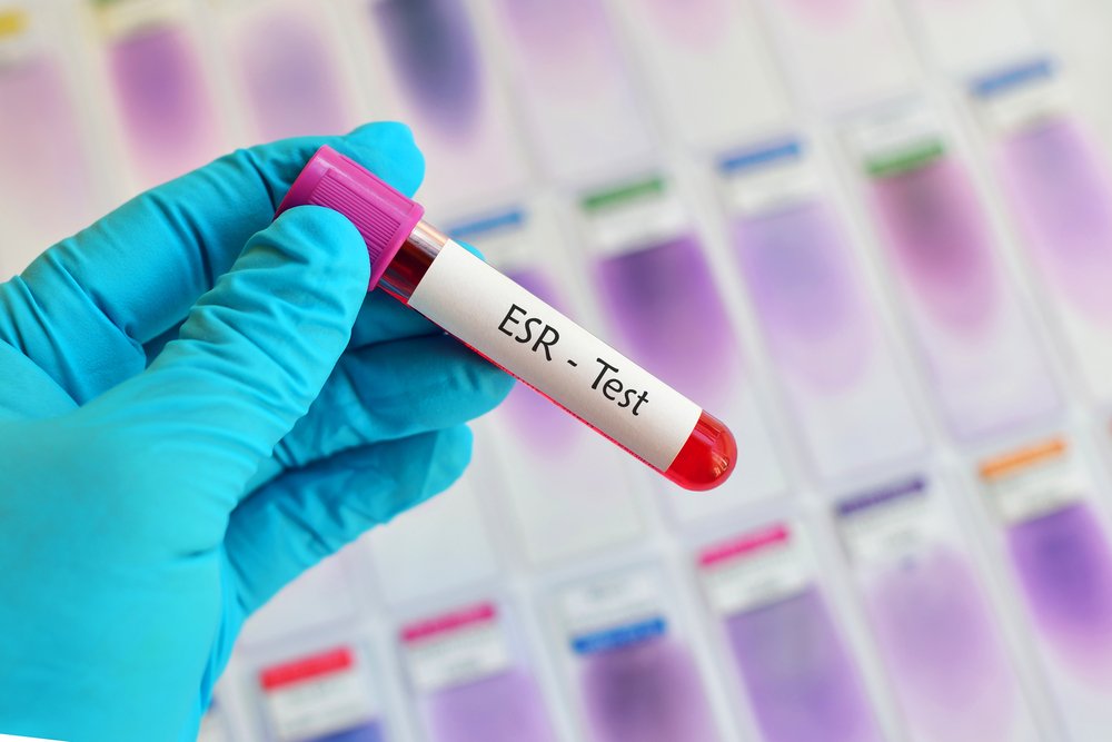 ERYTHROCYTE SEDIMENTATION RATE (ESR)