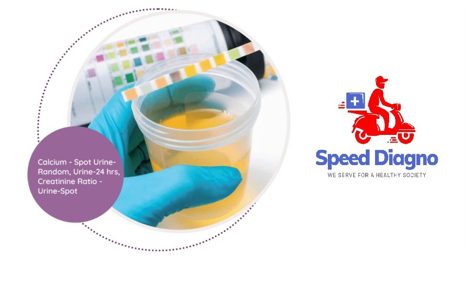 URINARY CALCIUM / CREATININE RATIO