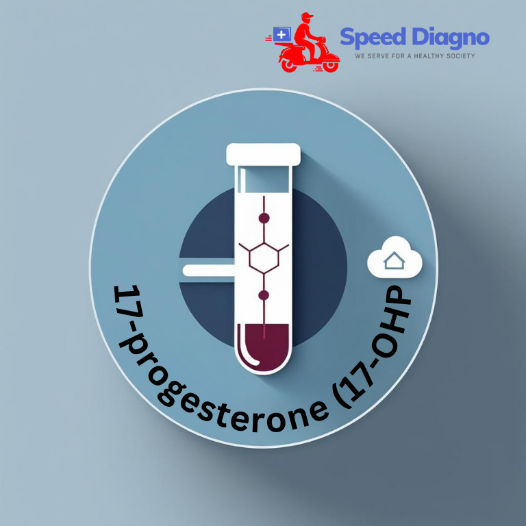 17-Hydroxyprogesterone (17-OHP)