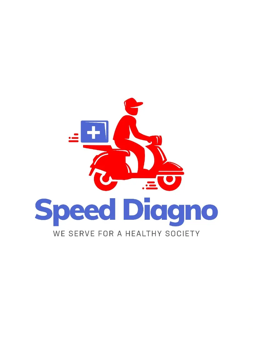 Tissue Transglutaminase (TTG) Antibody, IgA (CLIA)