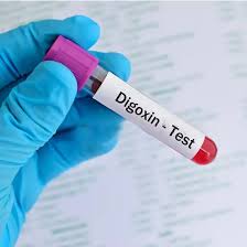 DIGOXIN, SERUM