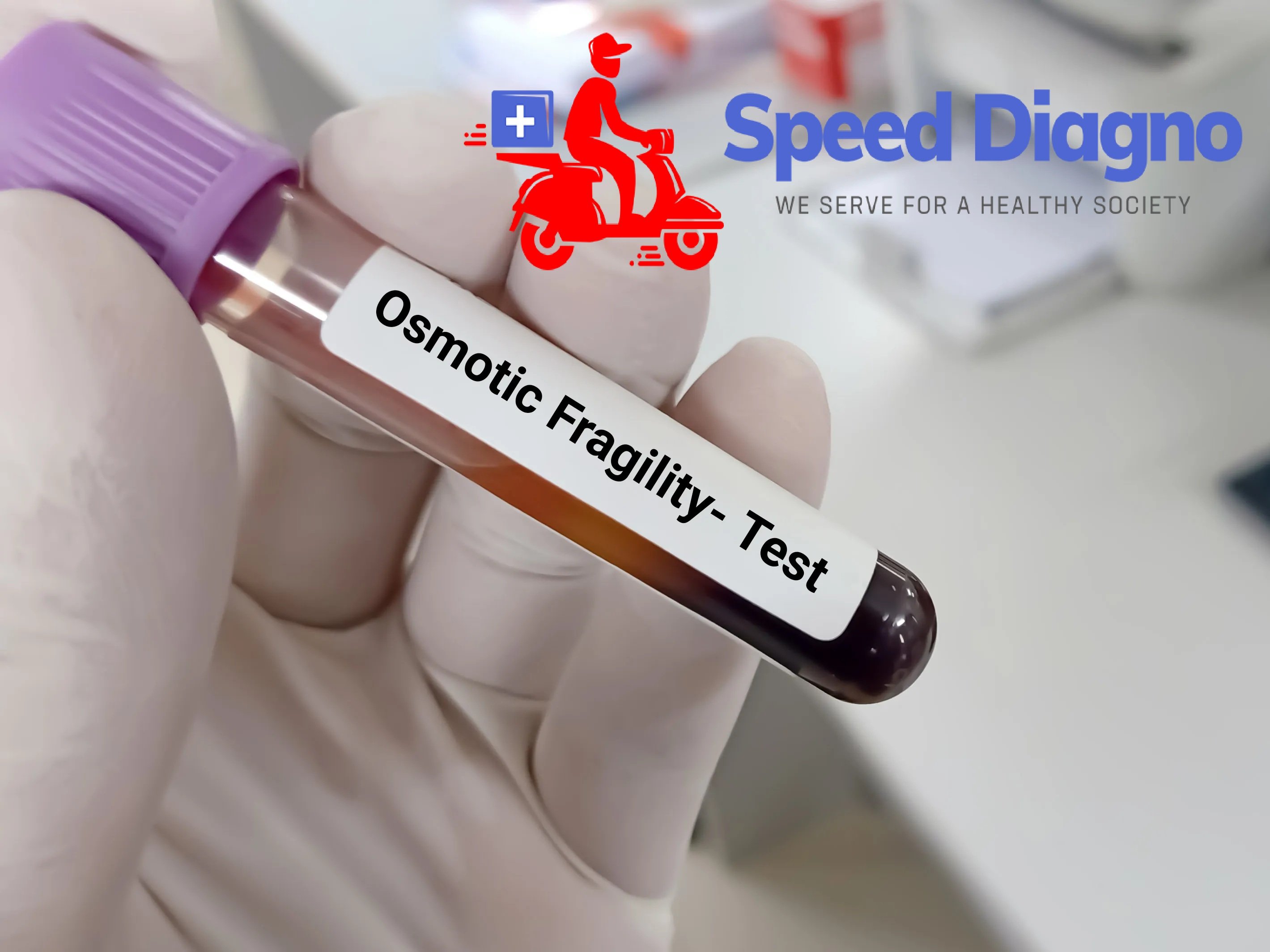 Osmotic Fragility