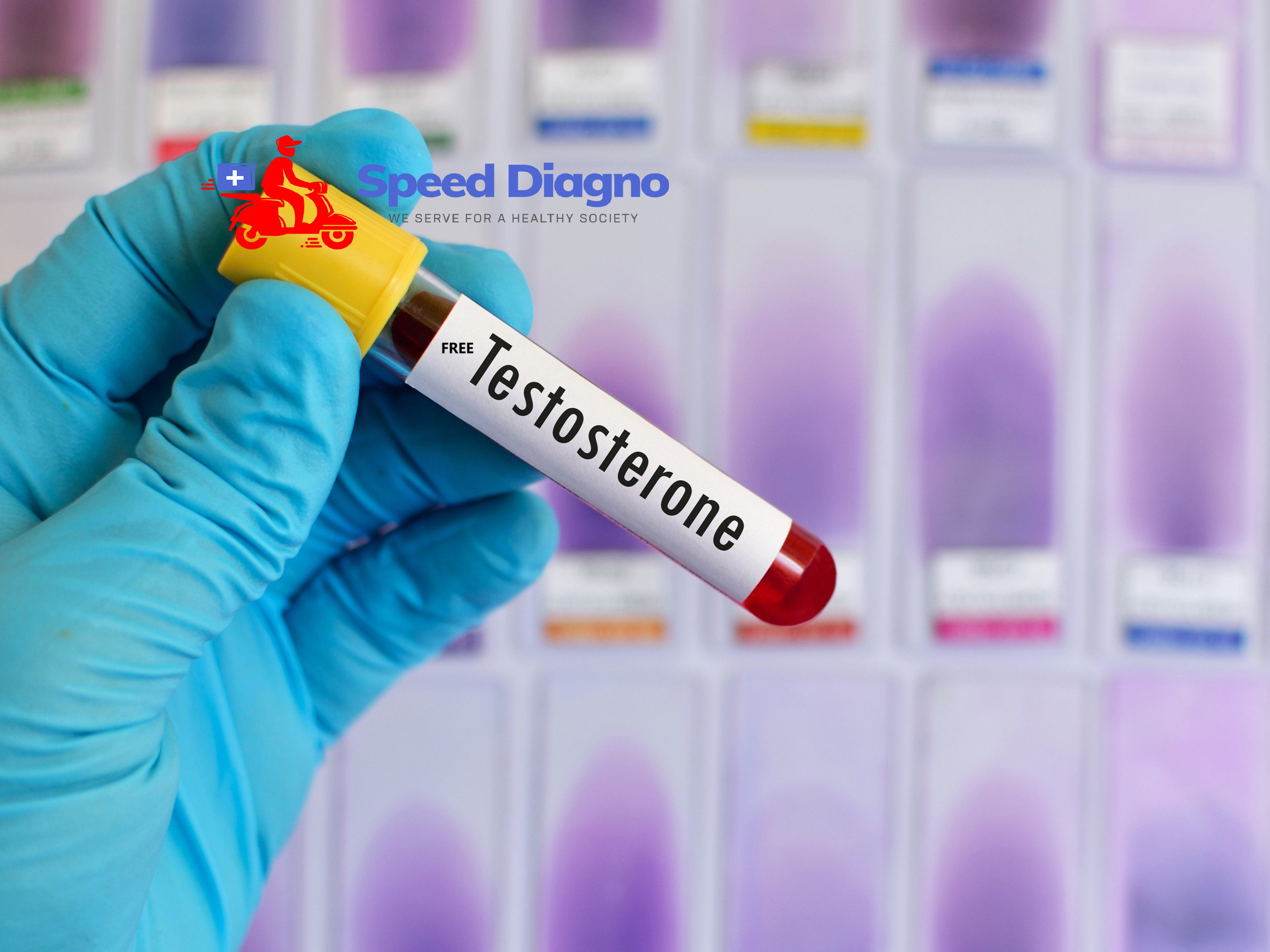 TESTOSTERONE - FREE