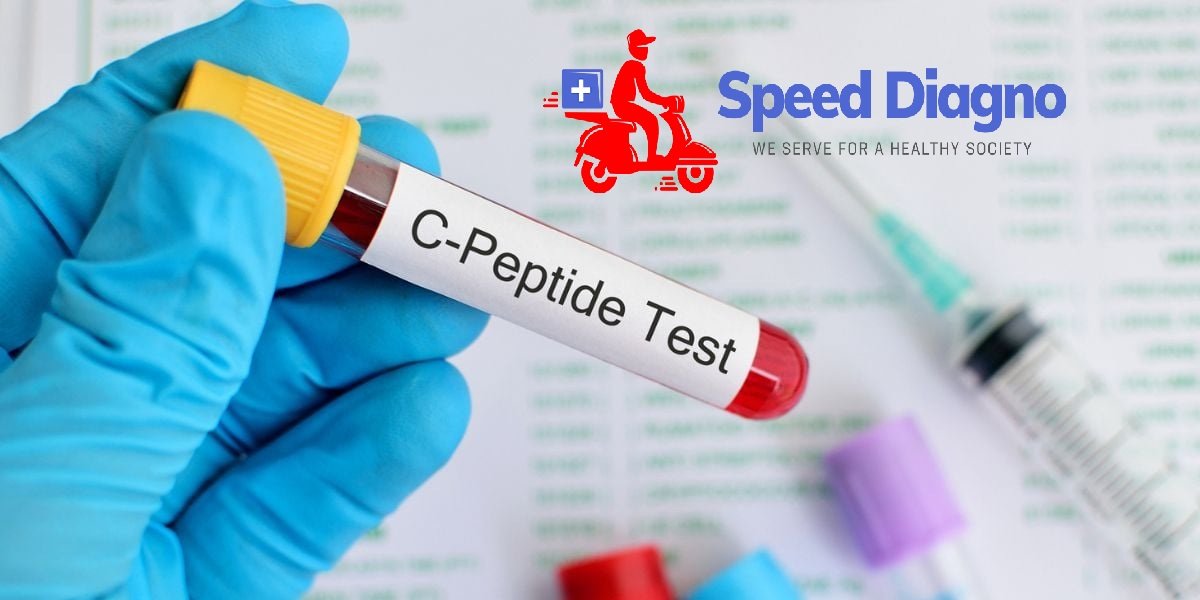 C-PEPTIDE