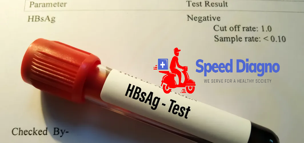 HBSAg -ELISA