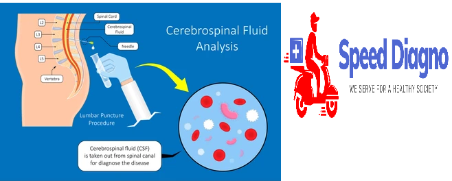 CSF - PCR REPORT