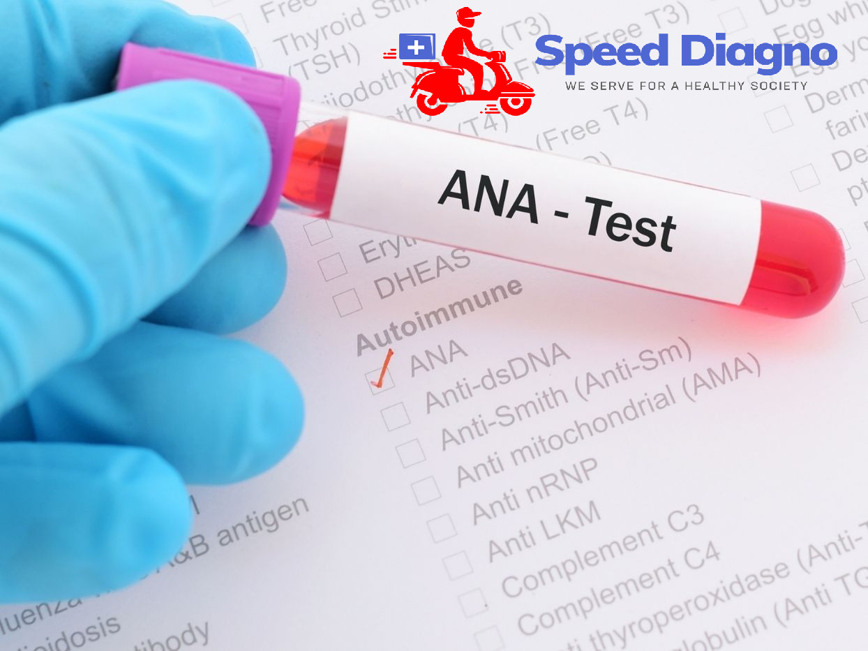 ANTI NUCLEAR ANTIBODY ( ANA ) - ELISA