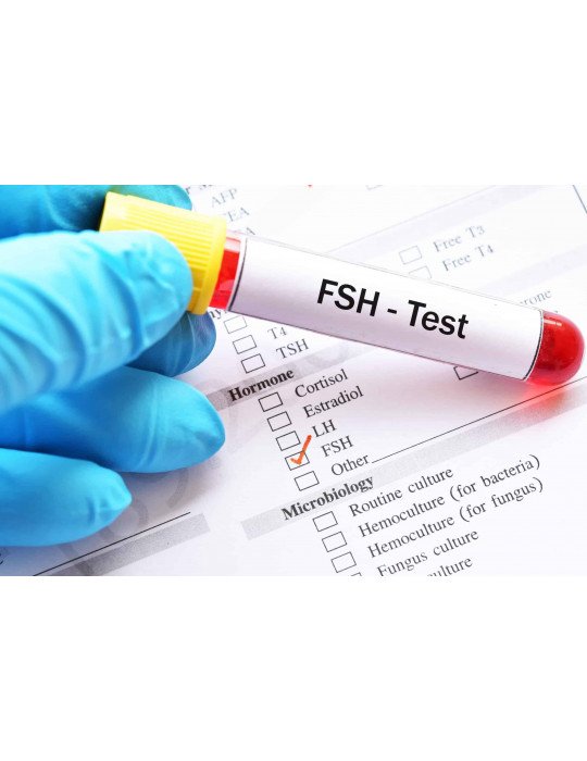 FOLLICLE STIMULATING HORMONE ( FSH )