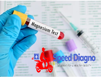 MAGNESIUM - SERUM