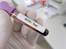 ADRENOCORTICOTROPIC HORMONE ( ACTH )
