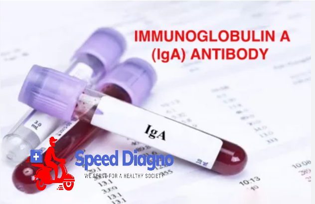 IGA - IMMUNOGLOBULIN A