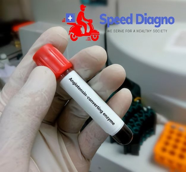 ACE (ANGIOTENSIN CONVERTING ENZYME)
