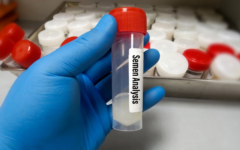 SEMEN ANALYSIS