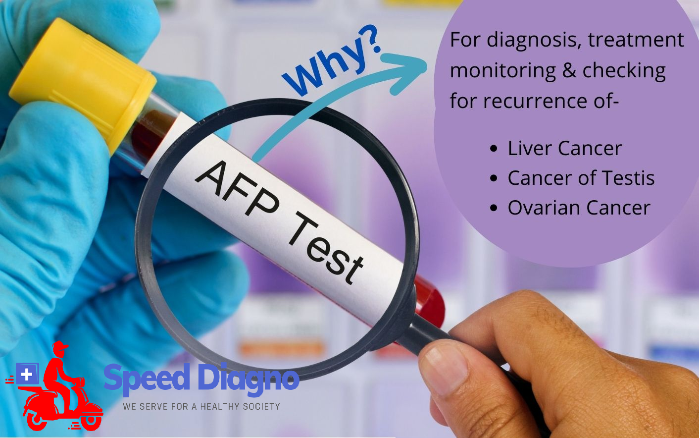 ALPHA FETO PROTEIN ( AFP )