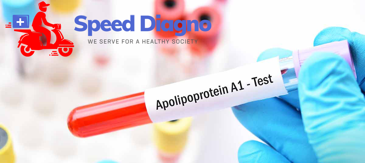 APOLIPOPROTEIN A1