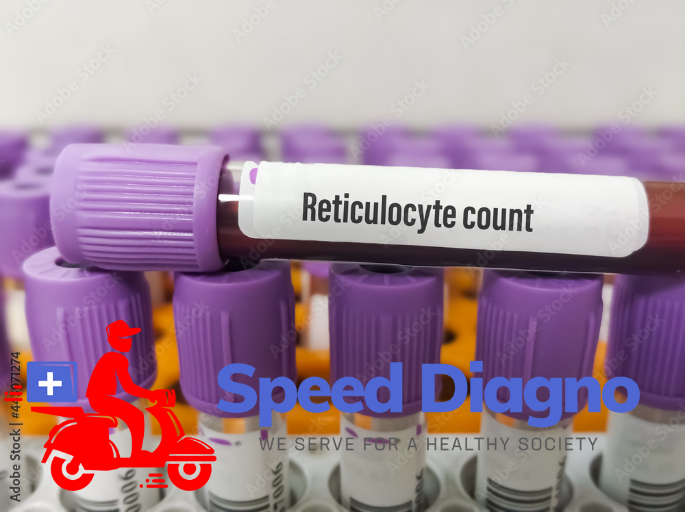 RETICULOYTE COUNT