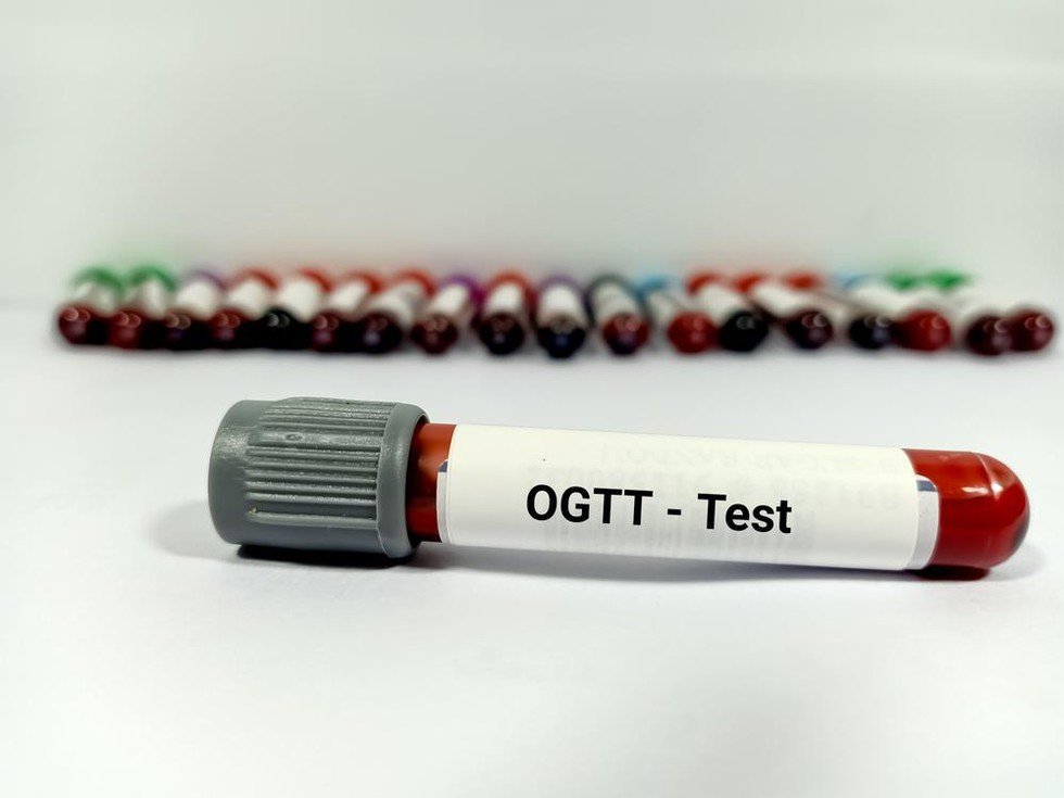 Blood sugar 1h (O-GTT, 1h)