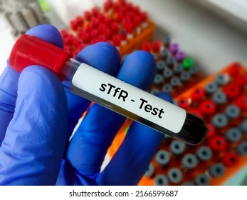 Serum Transferrin