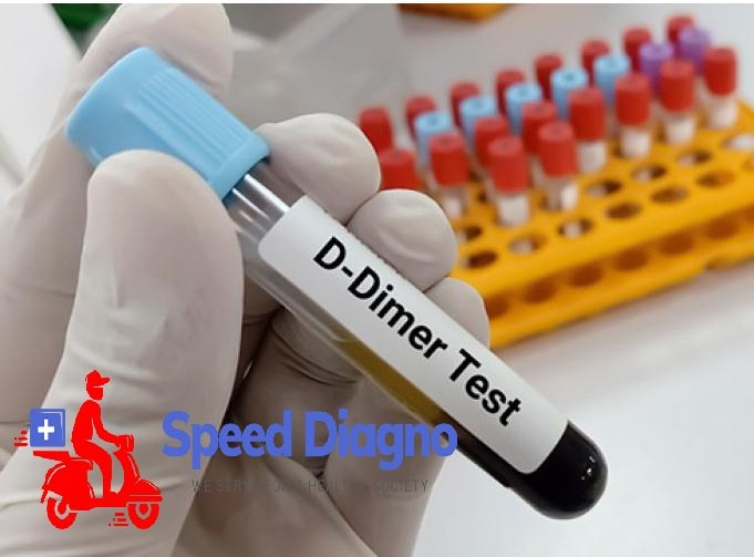 D - DIMER