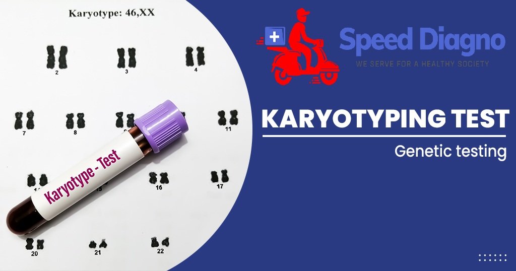 Karyotyping (Peripheral Blood)