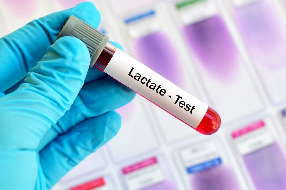 LACTATE