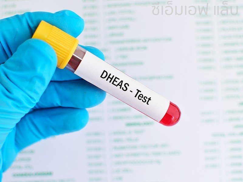 DEHYDROEPIANDROSTERONE SULPHATE (DHEA-S)