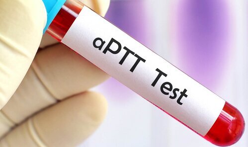 Activated Partial Thromboplastin Time (APTT)