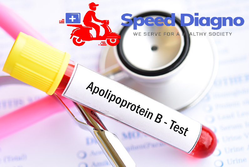 APOLIPOPROTEIN B