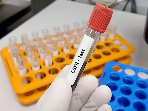 EGFR (GLOMERULAR FILTRATION RATE, ESTIMATED)
