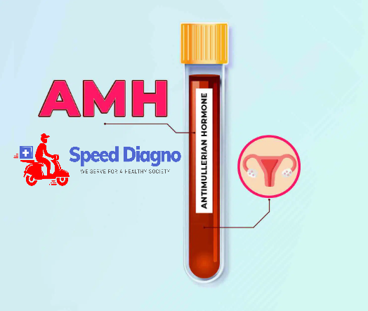 ANTI MULLERIAN HORMONE ( AMH )
