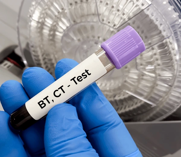 Bleeding Time & Clotting Time