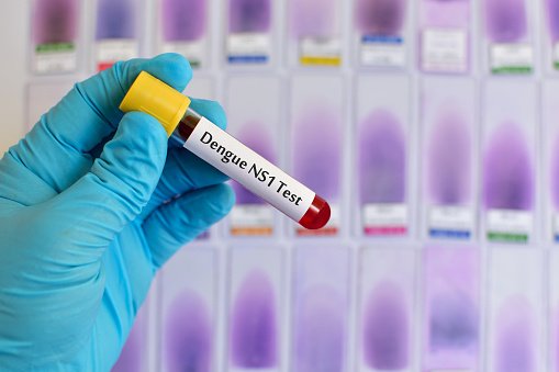 DENGUE NS1 ANTIGEN (RAPID)