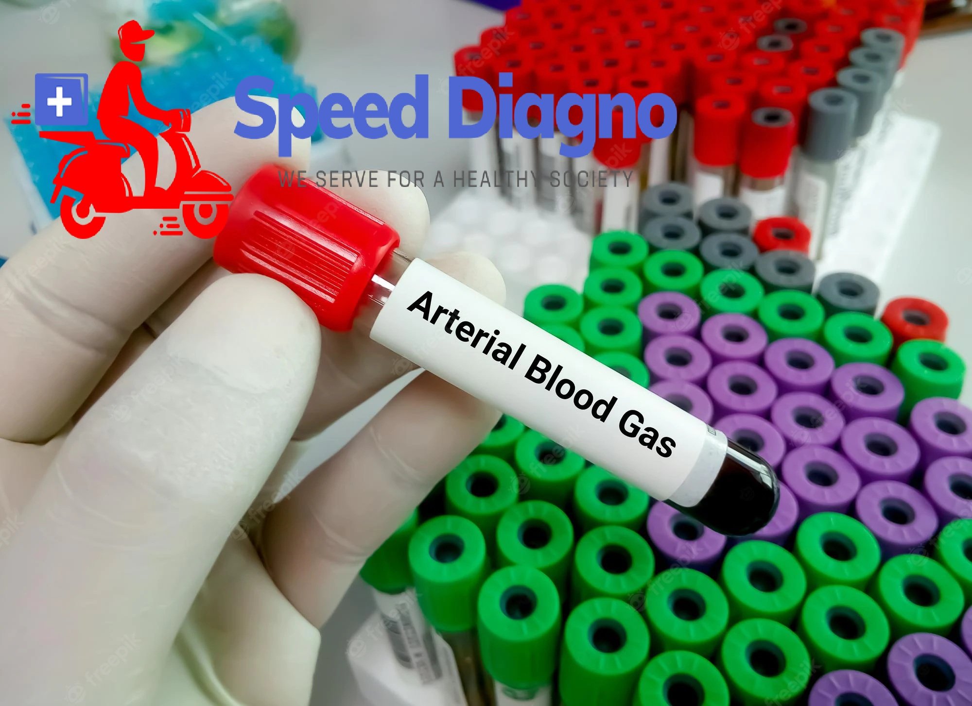 ARTERIAL BLOOD GASES ( ABG )