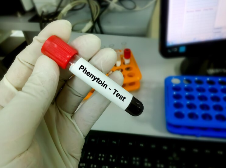 Phenytoin (Eptoin)