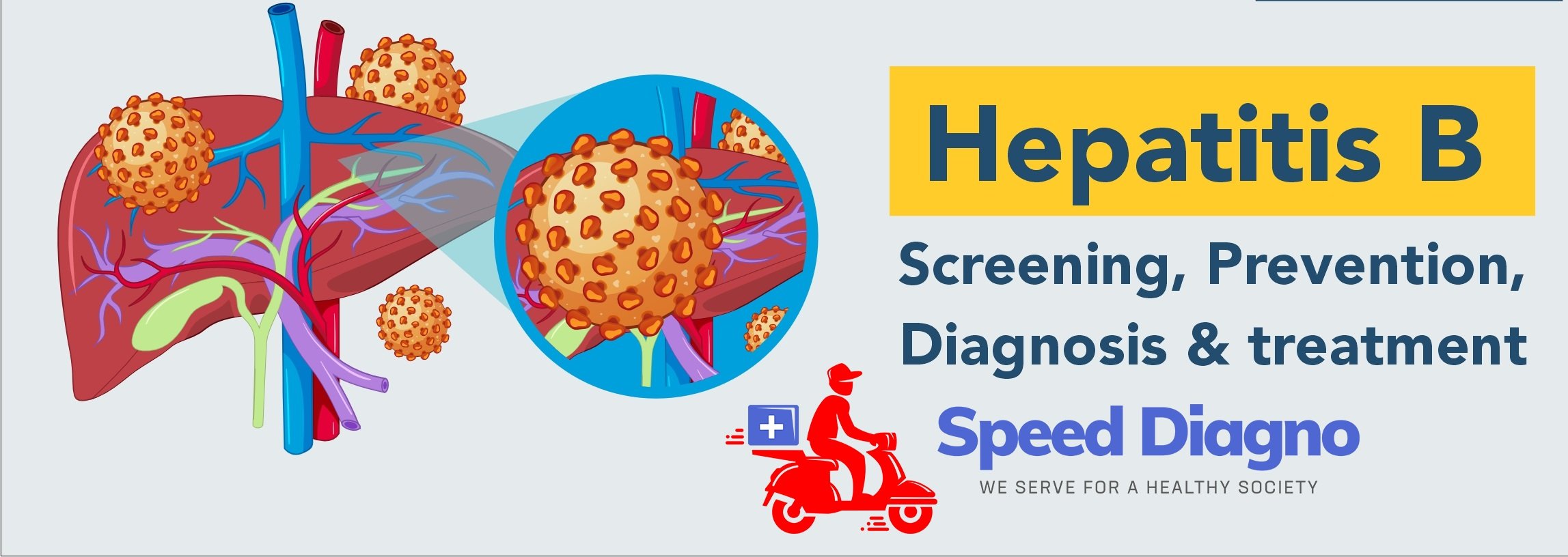HEPATITIS B VIRUS ENVELOPE ANTIGEN ( HBeAg )