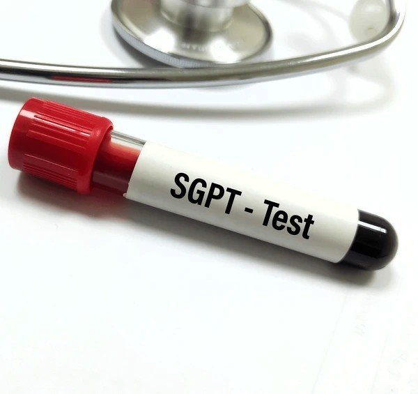SGPT/ALT (ALANINE TRANSAMINASE)