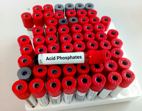 ACID PHOSPHATASE TOTAL