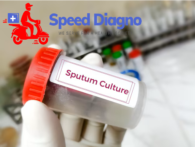 SPUTUM FOR CULTURE AND SENSITIVITY