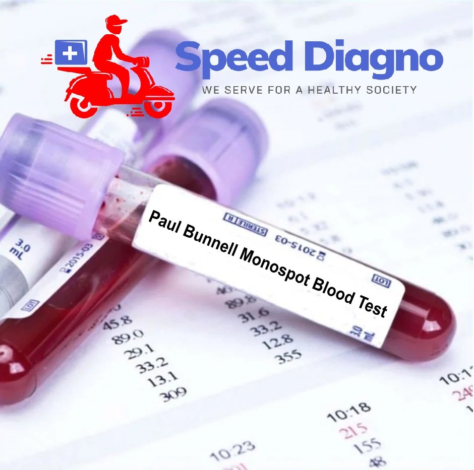 PAUL BUNNEL TEST (MONOSPOT)