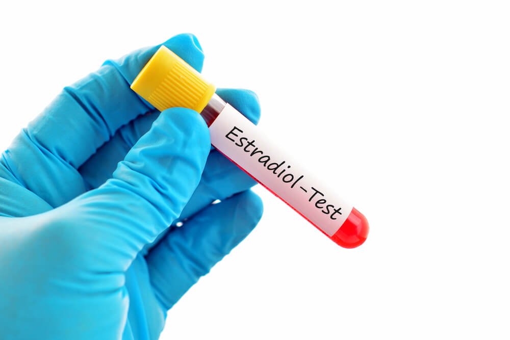 ESTRADIOL ( E2 )