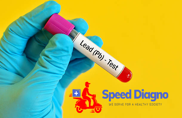 LEAD TEST