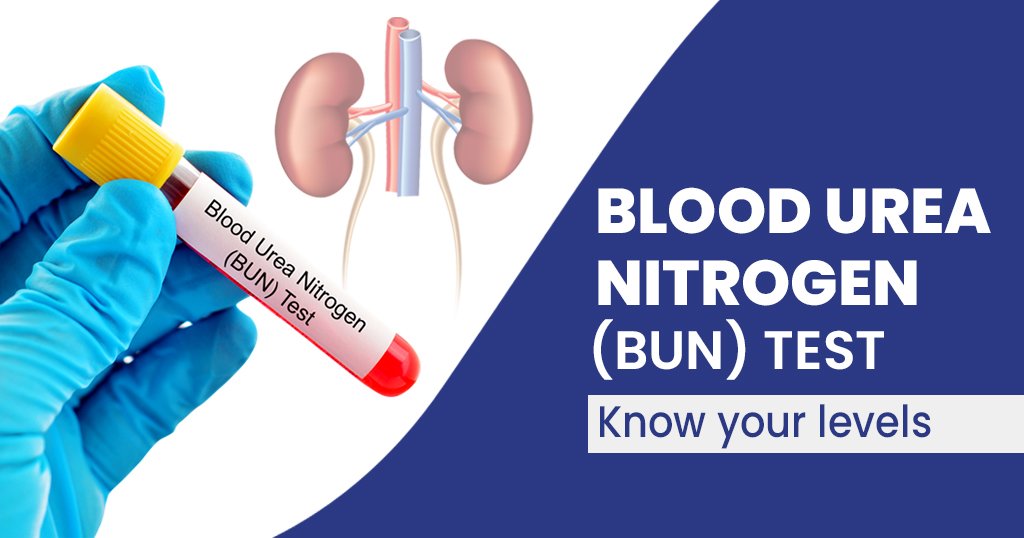 BLOOD UREA LEVEL ( BUL )
