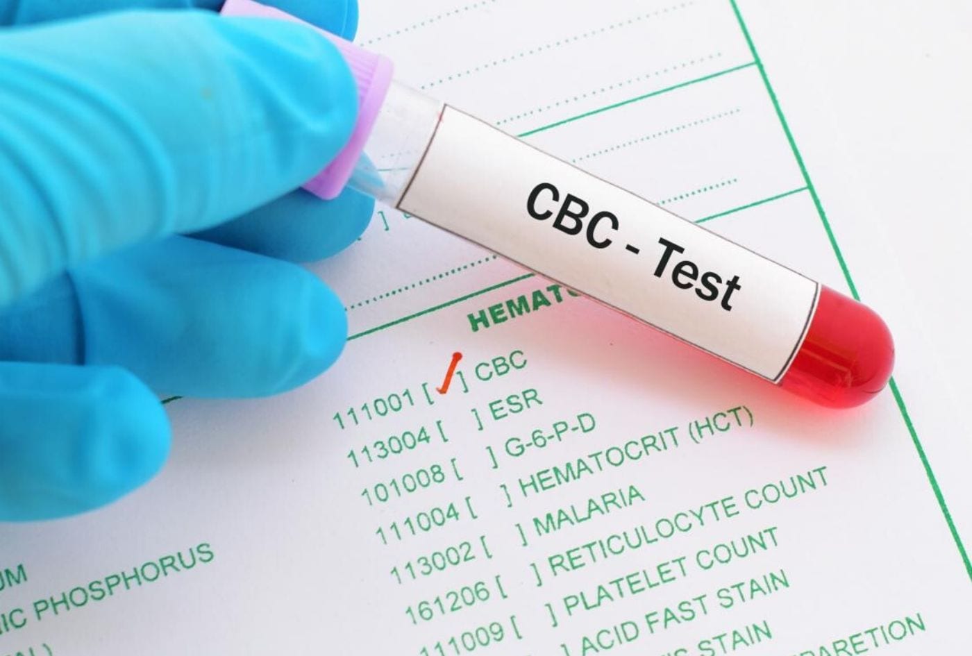 COMPLETE BLOOD PICTURE (CBP)
