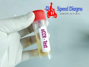 CREATININE CLEARANCE ( 24 HRS URINE )